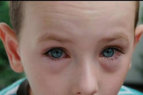 EDITORIAL: Los ojos de la infancia y el espejo negro: un llamado a la conciencia parental